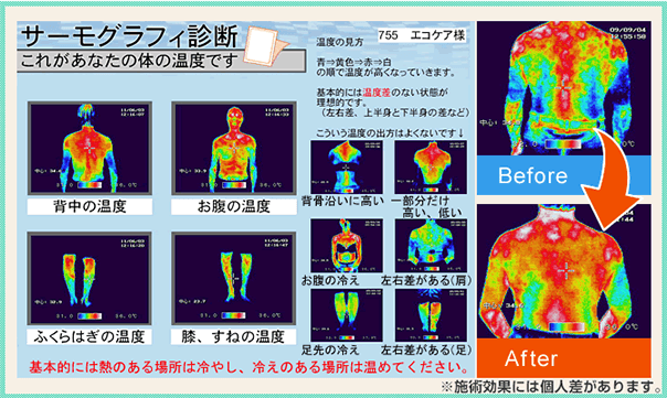 サーモグラフィ診断