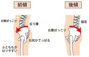 骨盤の角度