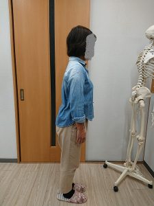 スーパーバナナタイプ