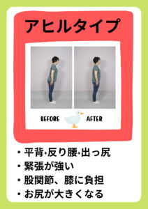 姿勢がアヒルタイプの例